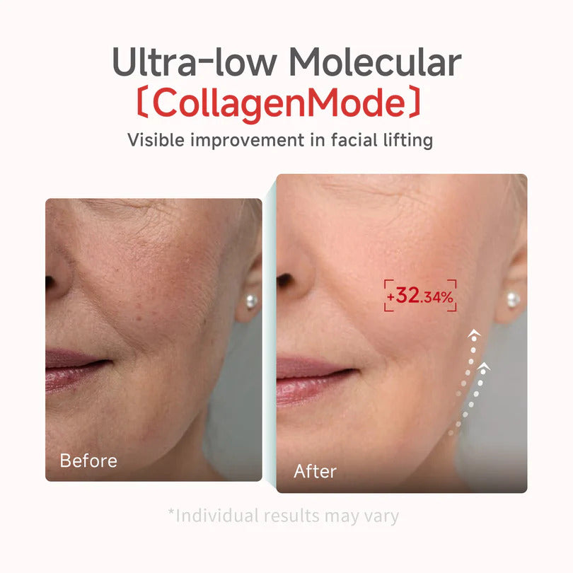 CDL Ultra-Low Molecular CollagenMode Lifting Mask (1box (5ea)) 칸도럽 저분자 콜라겐 리프팅 마스크 (1box (5개입))